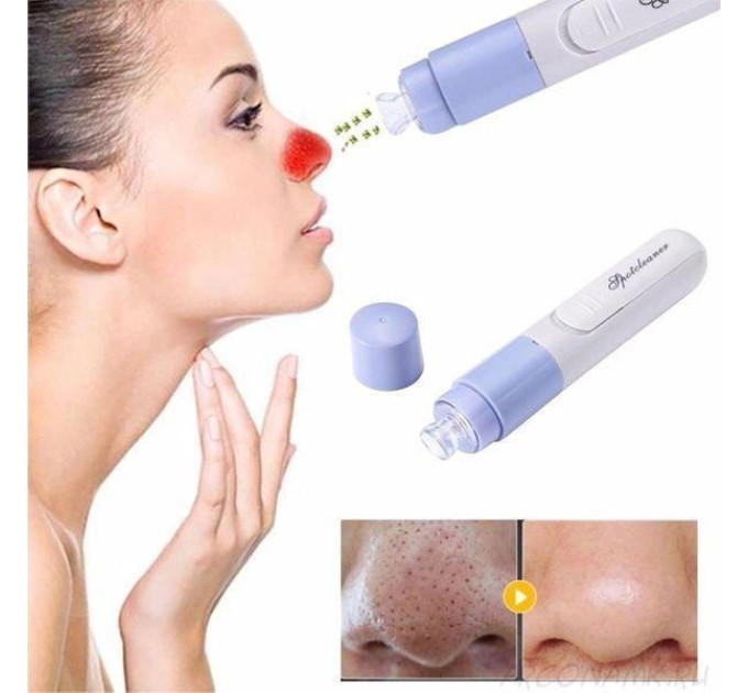 Вакуумный очиститель SPOTCLEANER Face Pore Cleaner вакуумный очиститель пор лица